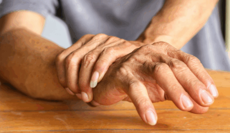 احذر.-تناول-هذه-الأغذية-يزيد-مخاطر-الإصابة-بمرض-شلل-الرعاش
