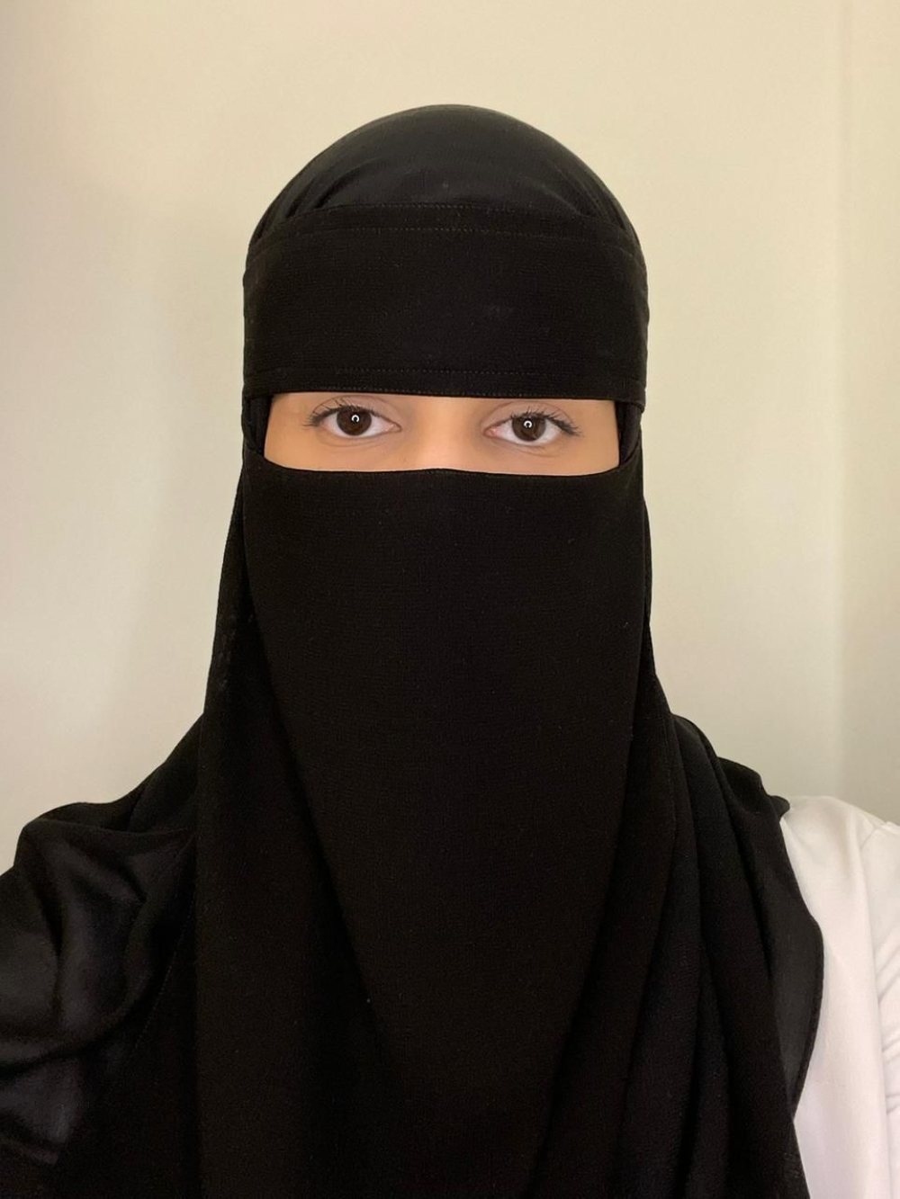 حالة-مزمنة.-طبيبة-توضح-لـ-“اليوم”-طرق-تقليل-حدة-نوبات-الصداع-النصفي