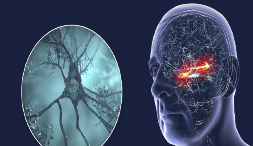 أداة-جديدة-تتنبأ-بخطر-ألزهايمر-قبل-سنوات-من-ظهور-الأعراض