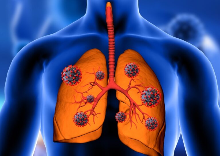 الانسداد-الرئوي-المزمن.-5-أعراض-و5-نصائح-أهمها-الإقلاع-عن-التدخين