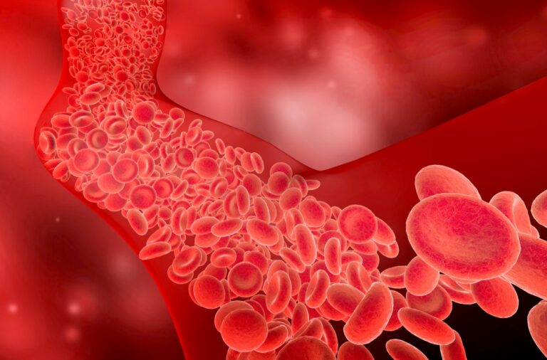 التخثّر-الوريدي-أثناء-السفر.-ما-هو-وكيف-تحمي-نفسك؟