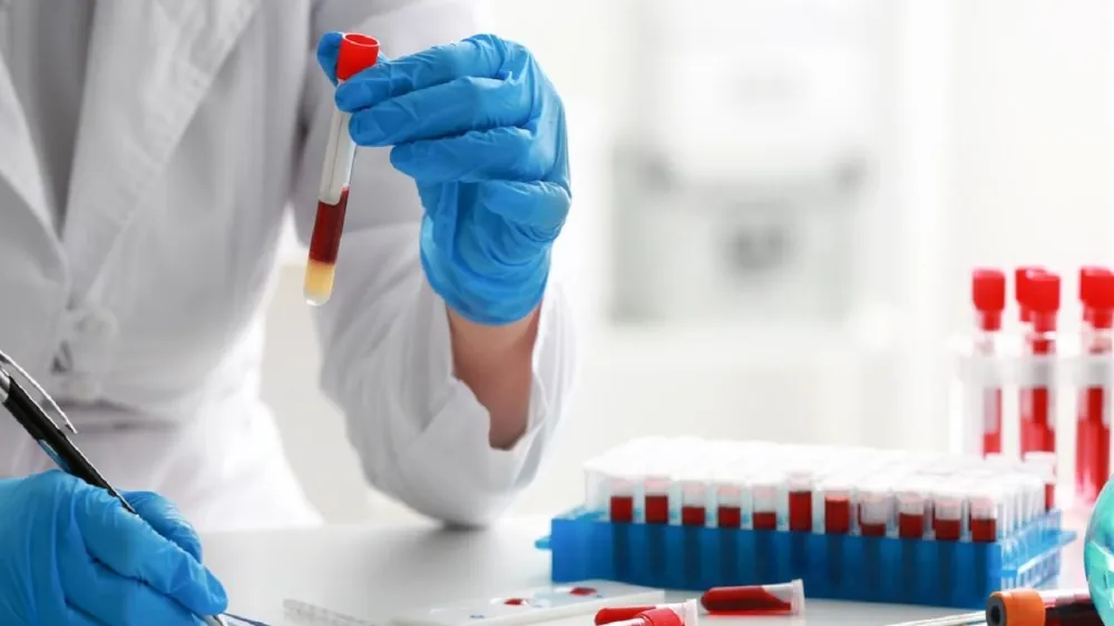 فقر-الدم-لدى-الأطفال.-6-أسباب-و3-عوامل-خطر-منها-الولادة-المبكرة