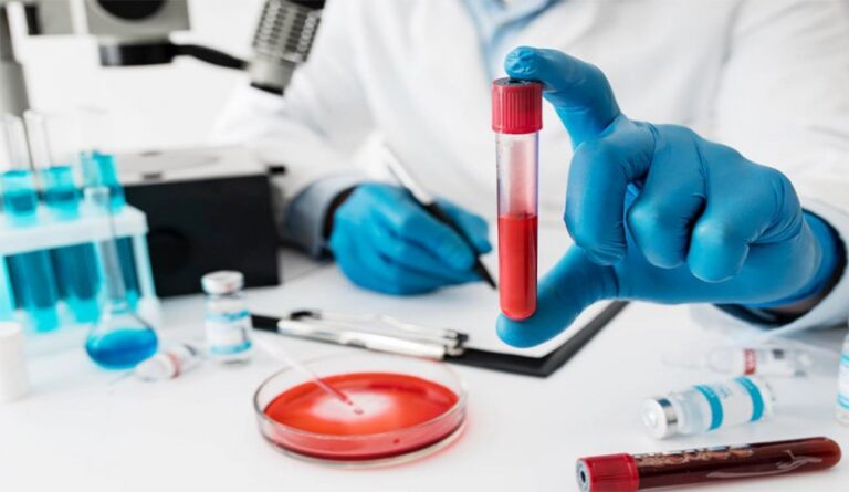 طريقة-سريعة-لكشف-‘مقياس’-المناعة-في-الدم