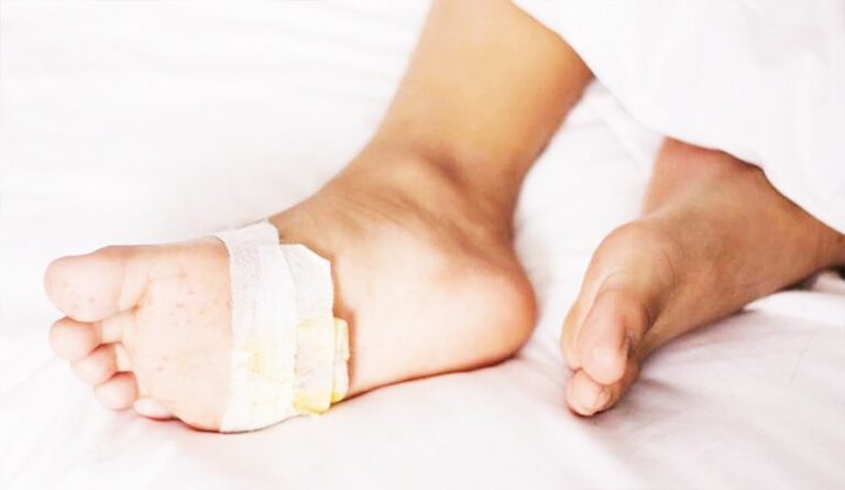 تطوير-‘جل’-لمرضى-السكري-يمنع-بتر-الأطراف