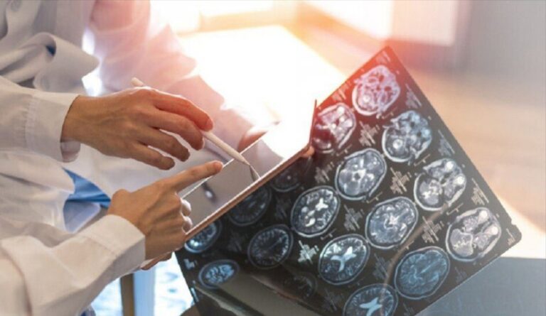 دراسة:-بروتين-يقلل-خطر-إصابة-الناجين-من-السرطان-بالخرف