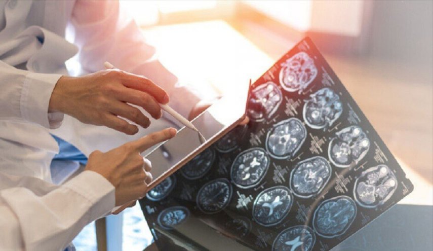 دراسة:-بروتين-يقلل-خطر-إصابة-الناجين-من-السرطان-بالخرف