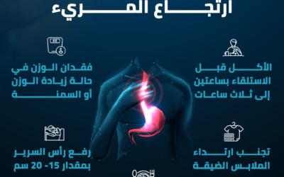 ارتجاع المريء.. يرهق المعدة في رمضان و10 طرق للتغلب عليه