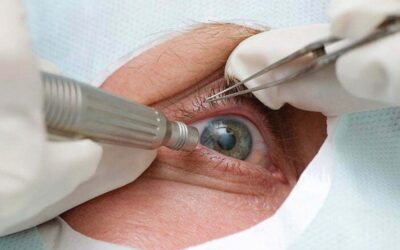 في الأسبوع العالمي للجلوكوما.. 6 أعراض و8 عوامل خطورة