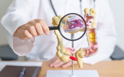 استشاري لـ “اليوم”: التوتر وراء تهيج القولون.. وتقليل الضغوط علاج استباقي