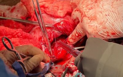 تقنية متقدمة بمدينة الملك سعود الطبية للسيطرة على نزيف الولادة دون استئصال الرحم