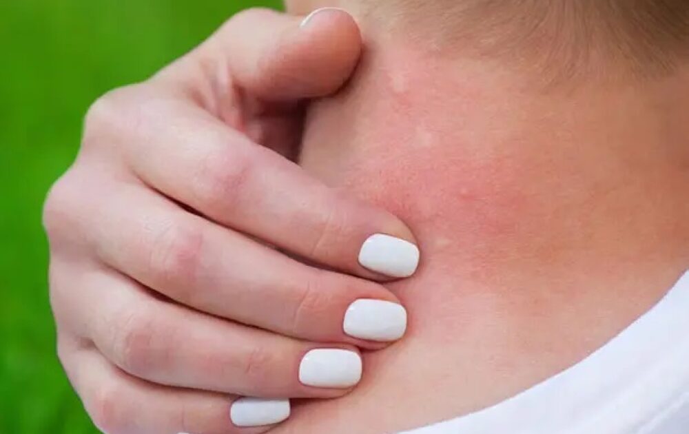 اليوم العالمي لمرض شاغاس.. دعوة عالمية للانتباه إلى مرض خطير “مهمل”