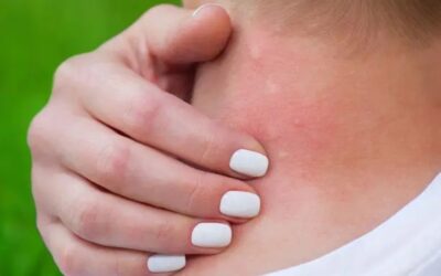 اليوم العالمي لمرض شاغاس.. دعوة عالمية للانتباه إلى مرض خطير “مهمل”