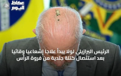 الرئيس البرازيلي لولا يبدأ علاجاً إشعاعياً وقائياً بعد استئصال كتلة جلدية من فروة الرأس
