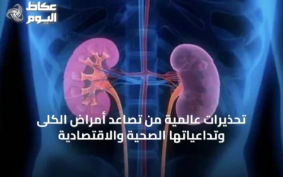 تحذيرات عالمية من تصاعد أمراض الكلى وتداعياتها الصحية والاقتصادية