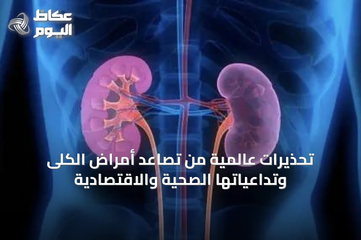 تحذيرات عالمية من تصاعد أمراض الكلى وتداعياتها الصحية والاقتصادية