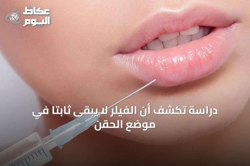 دراسة تكشف أن الفيلر لا يبقى ثابتًا في موضع الحقن