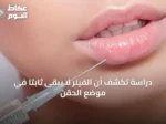 دراسة تكشف أن الفيلر لا يبقى ثابتًا في موضع الحقن