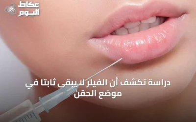 دراسة تكشف أن الفيلر لا يبقى ثابتًا في موضع الحقن