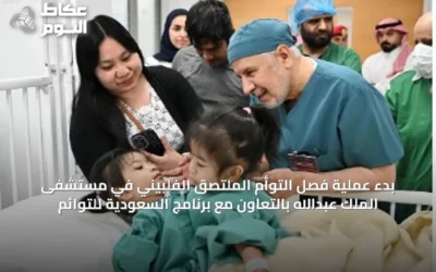 بدء عملية فصل التوأم الملتصق الفلبيني في مستشفى الملك عبدالله بالتعاون مع برنامج السعودية للتوائم