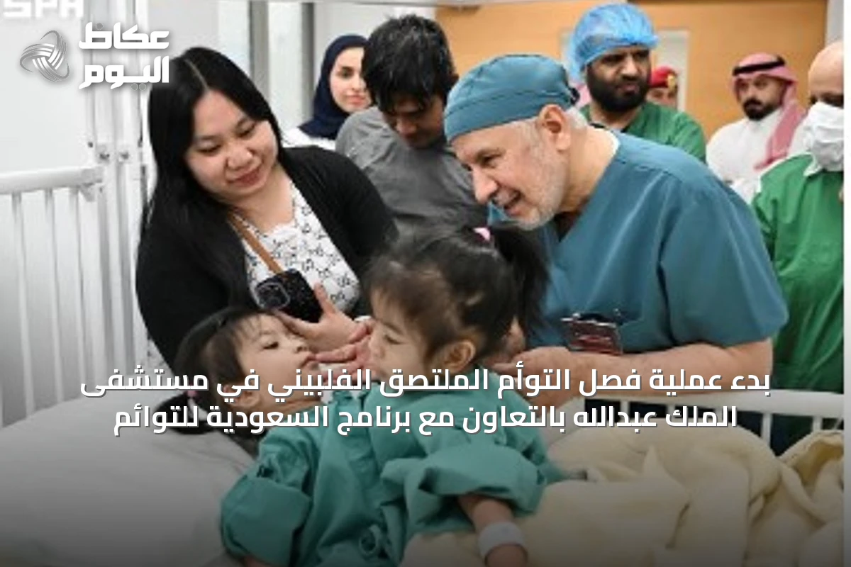 بدء عملية فصل التوأم الملتصق الفلبيني في مستشفى الملك عبدالله بالتعاون مع برنامج السعودية للتوائم