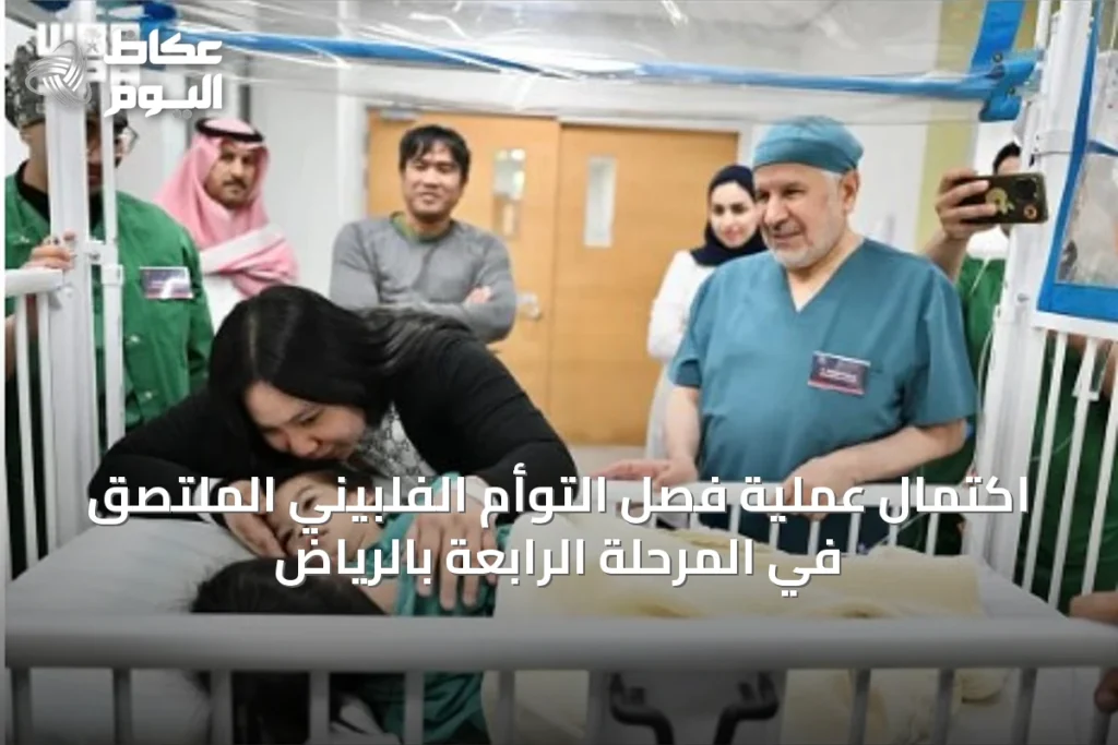 اكتمال عملية فصل التوأم الفلبيني الملتصق في المرحلة الرابعة بالرياض