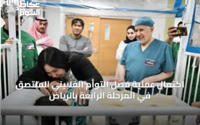 اكتمال عملية فصل التوأم الفلبيني الملتصق في المرحلة الرابعة بالرياض