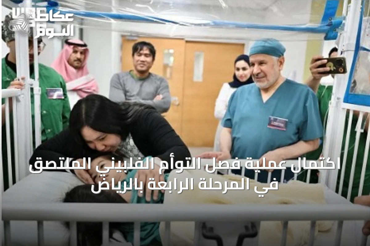 اكتمال عملية فصل التوأم الفلبيني الملتصق في المرحلة الرابعة بالرياض