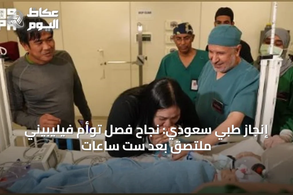 إنجاز طبي سعودي: نجاح فصل توأم فيليبيني ملتصق بعد ست ساعات