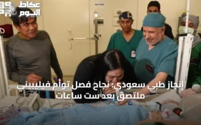 إنجاز طبي سعودي: نجاح فصل توأم فيليبيني ملتصق بعد ست ساعات