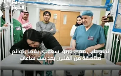نجاح طبي مميز: فريق سعودي يفصل توائم ملتصقة من الفلبين بعد ست ساعات