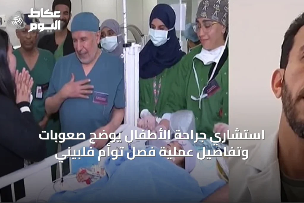 استشاري جراحة الأطفال يوضح صعوبات وتفاصيل عملية فصل توأم فلبيني