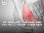 تقنية «انصمام الشريان الركبي» تخفض آلام خشونة الركبة إلى النصف وتُحسن جودة الحياة