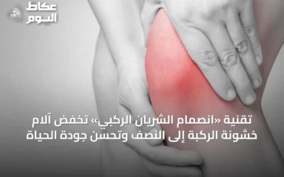 تقنية «انصمام الشريان الركبي» تخفض آلام خشونة الركبة إلى النصف وتُحسن جودة الحياة