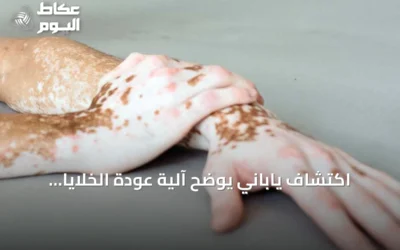 اكتشاف ياباني يوضح آلية عودة الخلايا الصبغية إلى حالة غير نشطة في البهاق