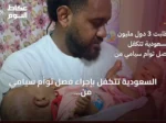 السعودية تتكفل بإجراء فصل توأم سيامي من فيجي مجانًا