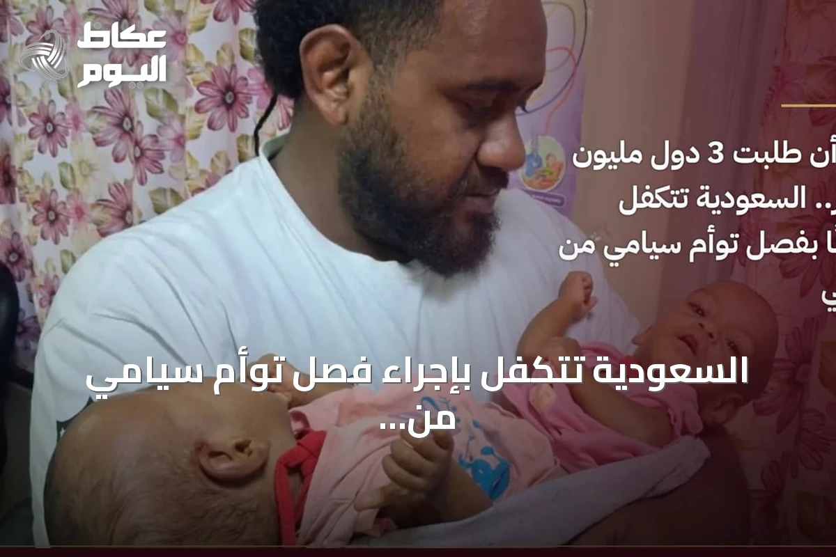 السعودية تتكفل بإجراء فصل توأم سيامي من فيجي مجانًا