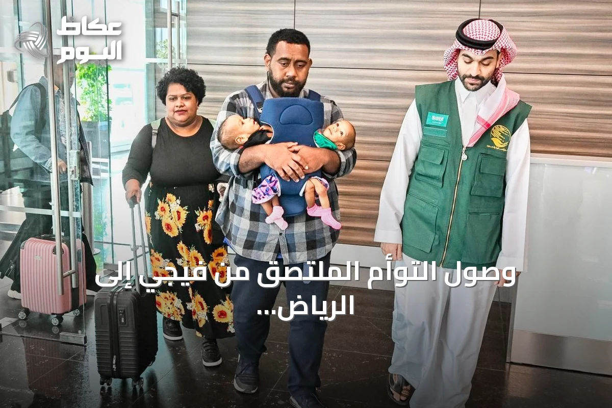 وصول التوأم الملتصق من فيجي إلى الرياض لدراسة حالتهما وإمكانية فصلهما