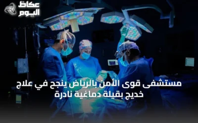 مستشفى قوى الأمن بالرياض ينجح في علاج خديج بقيلة دماغية نادرة