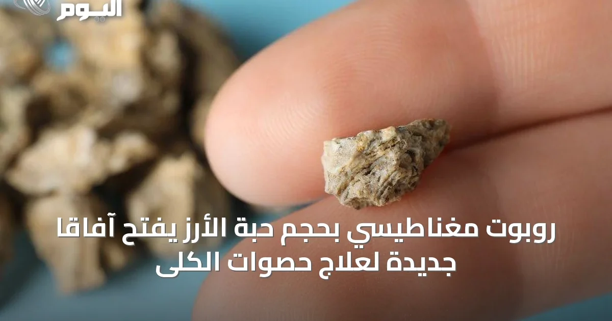 روبوت مغناطيسي بحجم حبة الأرز يفتح آفاقاً جديدة لعلاج حصوات الكلى