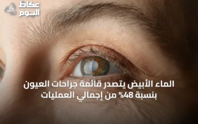 الماء الأبيض يتصدر قائمة جراحات العيون بنسبة 48% من إجمالي العمليات