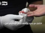 اختبار دم جديد يكشف خطر ألزهايمر قبل سنوات من ظهور الأعراض