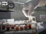 فحص دم تجريبي يحدد الزوائد الخطرة التي قد تتحول إلى سرطان القولون
