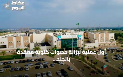 أول عملية لإزالة حصوات كلوية معقدة بالجلد تُجرى بمستشفى الأمير محمد بن ناصر بجازان