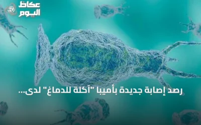 رصد إصابة جديدة بأميبا “آكلة للدماغ” لدى مراهق في كارولينا الشمالية