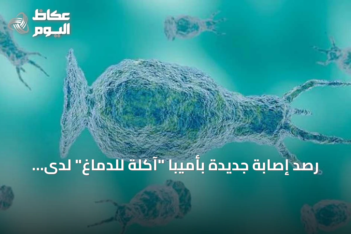 رصد إصابة جديدة بأميبا “آكلة للدماغ” لدى مراهق في كارولينا الشمالية