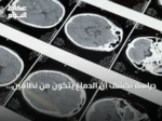 دراسة تكشف أن الدماغ يتكون من نظامين عصبيين منفصلين منذ المراحل المبكرة للجنين