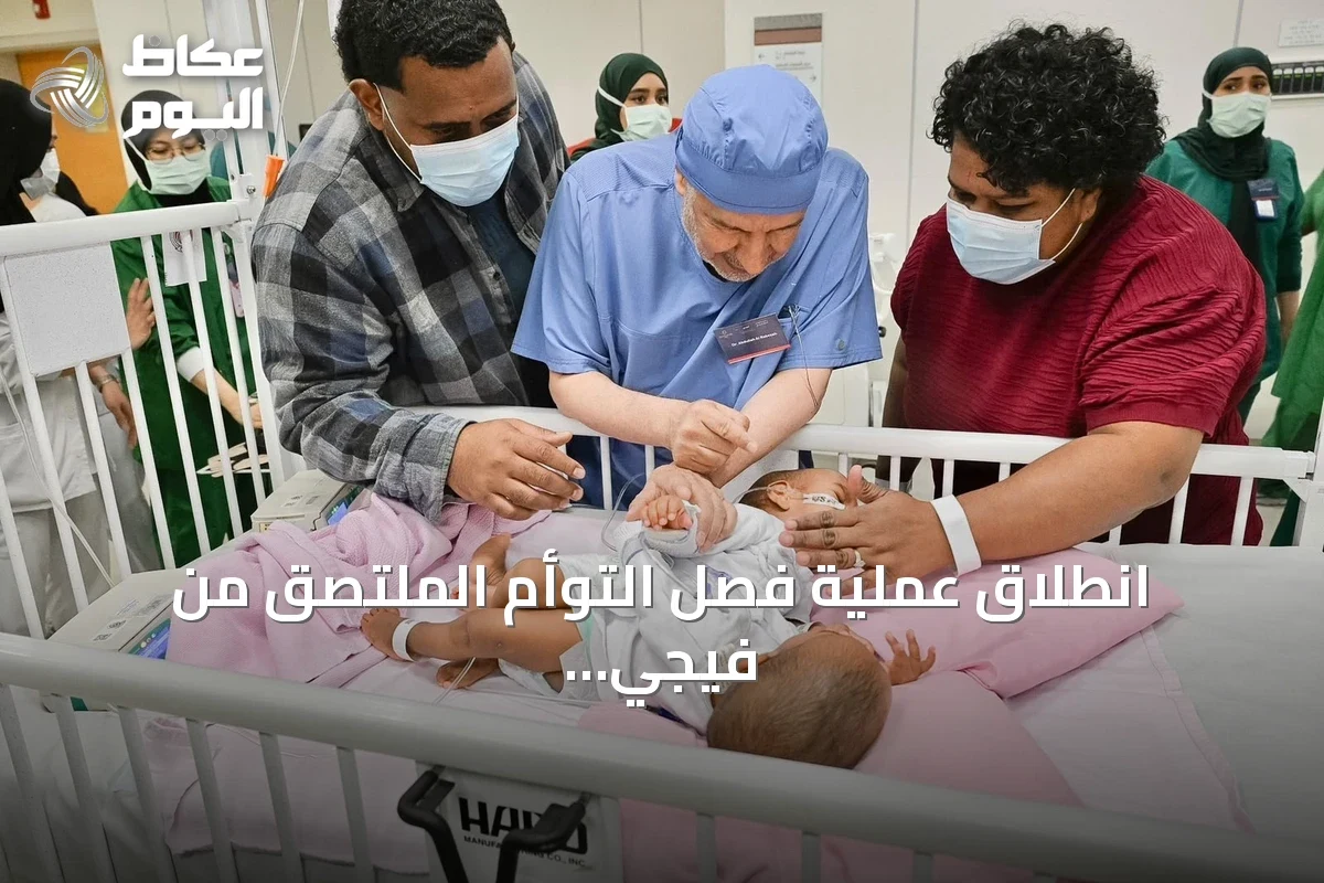 انطلاق عملية فصل التوأم الملتصق من فيجي في مستشفى الملك عبدالله التخصصي للأطفال بالرياض