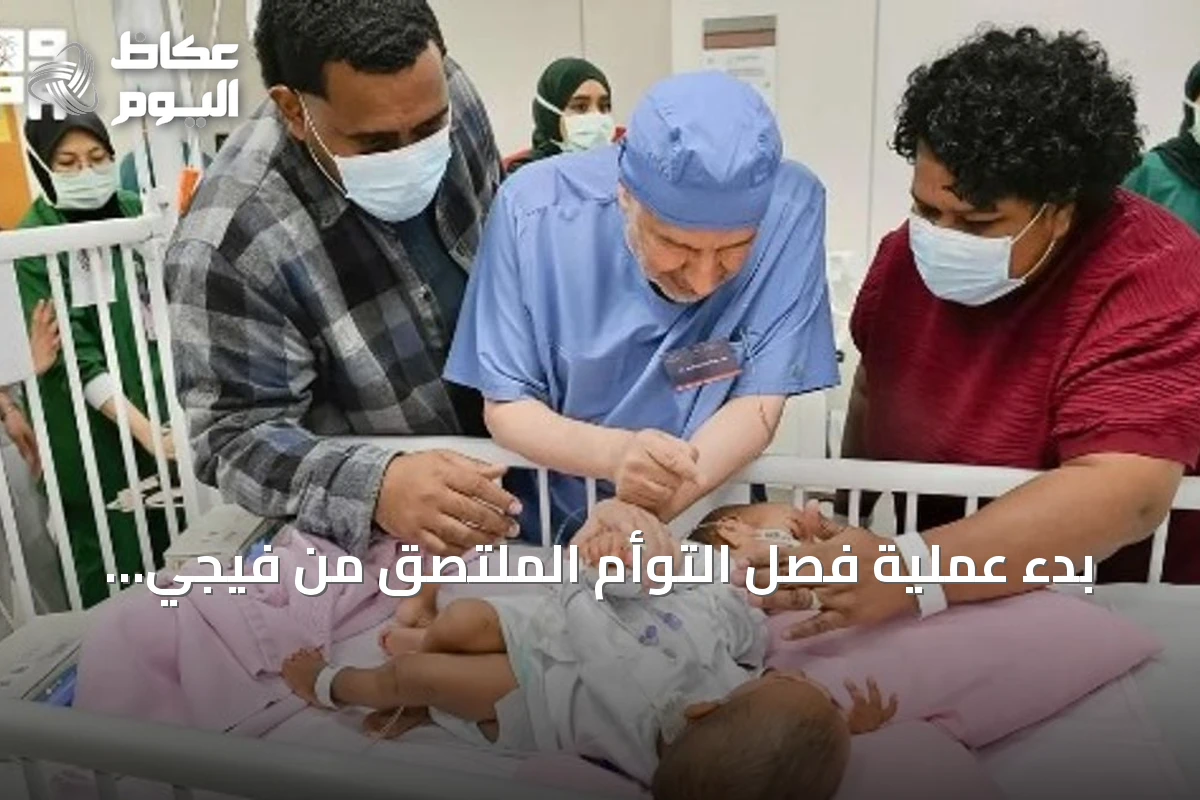 بدء عملية فصل التوأم الملتصق من فيجي بالرياض تنفيذاً لتوجيهات القيادة