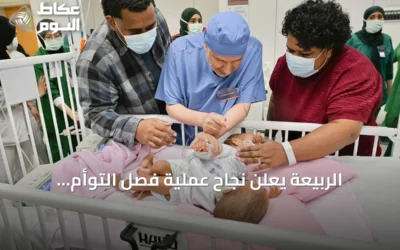 الربيعة يعلن نجاح عملية فصل التوأم الملتصق من فيجي