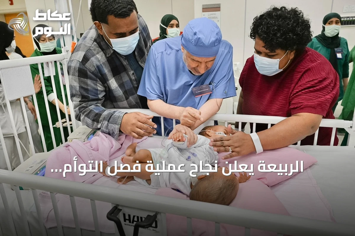 الربيعة يعلن نجاح عملية فصل التوأم الملتصق من فيجي